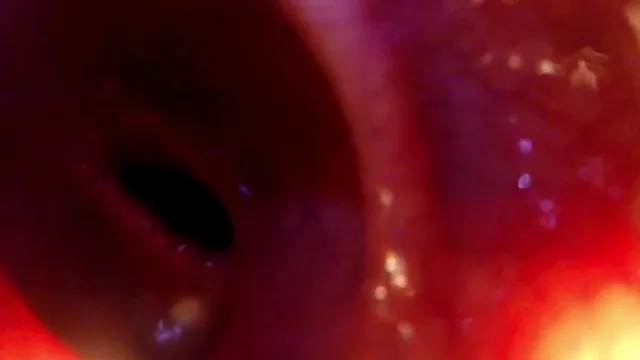 Amatuer, TheoreticalTop